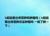 b超能看出肾囊肿和肿瘤吗（b超能看出肾囊肿还是肿瘤吗 一起了解一下）