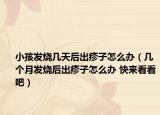 小孩发烧几天后出疹子怎么办（几个月发烧后出疹子怎么办 快来看看吧）