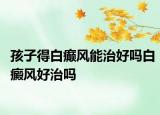 孩子得白癫风能治好吗白癜风好治吗
