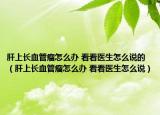 肝上长血管瘤怎么办 看看医生怎么说的（肝上长血管瘤怎么办 看看医生怎么说）