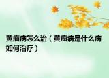 黄瘤病怎么治（黄瘤病是什么病 如何治疗）