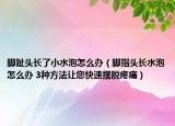 脚趾头长了小水泡怎么办（脚指头长水泡怎么办 3种方法让您快速摆脱疼痛）