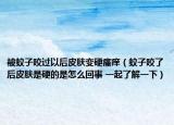 被蚊子咬过以后皮肤变硬瘙痒（蚊子咬了后皮肤是硬的是怎么回事 一起了解一下）