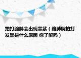 拍打胳膊会出现黑紫（胳膊腕拍打发黑是什么原因 你了解吗）