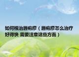 如何根治唇疱疹（唇疱疹怎么治疗好得快 需要注意这些方面）