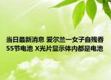 当日最新消息 爱尔兰一女子自残吞55节电池 X光片显示体内都是电池
