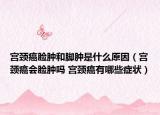 宫颈癌脸肿和脚肿是什么原因（宫颈癌会脸肿吗 宫颈癌有哪些症状）