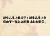 新生儿头上起痱子（新生儿头上有像痱子一样怎么回事 家长别着急）