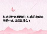 红痣是什么原因啊（红痣的出现意味着什么 红痣是什么）