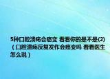 5种口腔溃疡会癌变 看看你的是不是(2)（口腔溃疡反复发作会癌变吗 看看医生怎么说）