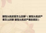 脚指头脱皮是怎么回事?（脚指头脱皮严重怎么回事 脚指头脱皮严重的原因）