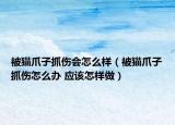 被猫爪子抓伤会怎么样（被猫爪子抓伤怎么办 应该怎样做）