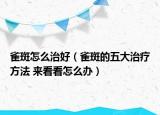 雀斑怎么治好（雀斑的五大治疗方法 来看看怎么办）