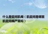 什么是壁间肌瘤（肌壁间是哪里 肌壁间瘤严重吗）