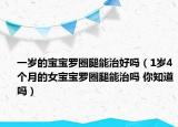 一岁的宝宝罗圈腿能治好吗（1岁4个月的女宝宝罗圈腿能治吗 你知道吗）