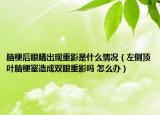 脑梗后眼睛出现重影是什么情况（左侧顶叶脑梗塞造成双眼重影吗 怎么办）