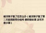 被洋辣子蛰了后怎么办（被洋辣子蛰了第二天能用胶带办粘吗 要积极处理 这可不是小事）