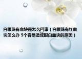 白眼珠有血块是怎么回事（白眼珠有红血块怎么办 5个容易造成眼白血块的原因）