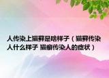 人传染上猫藓是啥样子（猫藓传染人什么样子 猫癣传染人的症状）