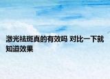 激光祛斑真的有效吗 对比一下就知道效果