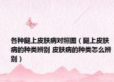 各种腿上皮肤病对照图（腿上皮肤病的种类辨别 皮肤病的种类怎么辨别）