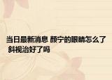 当日最新消息 颜宁的眼睛怎么了 斜视治好了吗
