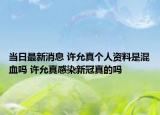 当日最新消息 许允真个人资料是混血吗 许允真感染新冠真的吗