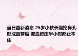 当日最新消息 25岁小伙长期挖鼻孔形成血管瘤 流血按压半小时都止不住