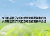 女孩阳后烧了2天自然卷变直发详细内容 女孩阳后烧了2天自然卷变直发具体介绍