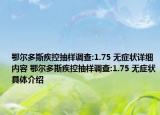 鄂尔多斯疾控抽样调查:1.75 无症状详细内容 鄂尔多斯疾控抽样调查:1.75 无症状具体介绍