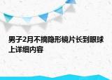 男子2月不摘隐形镜片长到眼球上详细内容