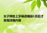 女子摔跤上牙磕进嘴唇1月后才发现详细内容