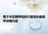 男子术后晒颅骨碎片最薄处像指甲详细内容