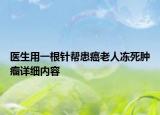 医生用一根针帮患癌老人冻死肿瘤详细内容