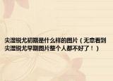尖湿锐尤初期是什么样的图片（无意看到尖湿锐尤早期图片整个人都不好了！）