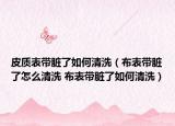 皮质表带脏了如何清洗（布表带脏了怎么清洗 布表带脏了如何清洗）