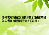 如何清洗牙齿的污垢和牙黄（牙齿长霉斑怎么洗掉 如何清洗牙齿上的霉斑）