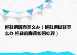 拖鞋磨脚面怎么办（拖鞋磨脚背怎么办 拖鞋磨脚背如何处理）