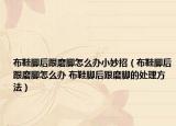 布鞋脚后跟磨脚怎么办小妙招（布鞋脚后跟磨脚怎么办 布鞋脚后跟磨脚的处理方法）