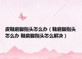 皮鞋磨脚指头怎么办（鞋磨脚指头怎么办 鞋磨脚指头怎么解决）