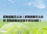 皮鞋磨脚怎么治（皮鞋磨脚怎么处理 皮鞋磨脚是否属于质量问题）