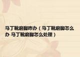马丁靴磨脚咋办（马丁靴磨脚怎么办 马丁靴磨脚怎么处理）