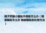 鞋子挤脚小脚趾外侧疼怎么办（鞋磨脚趾怎么办 鞋磨脚趾的处理方法）