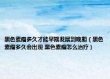 黑色素瘤多久才能早期发展到晚期（黑色素瘤多久会出现 黑色素瘤怎么治疗）